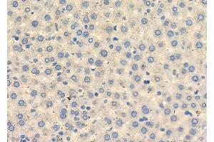 ABIN6262420 and ABIN6272672 at 1/100 staining Rat liver tissue by IHC-P.