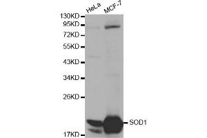 Western blot analysis of extracts of various cell lines, using SOD1 antibody (ABIN5970104) at 1/1000 dilution. (SOD1 Antikörper)