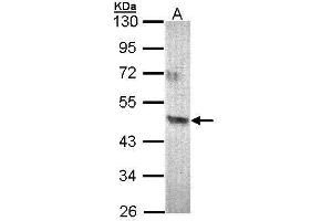 WB Image Sample (30 ug of whole cell lysate) A: 293T 10% SDS PAGE antibody diluted at 1:500 (Acad8 Antikörper)