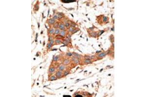 Immunohistochemistry (IHC) image for anti-Gap Junction Protein, alpha 3, 46kDa (GJA3) (AA 108-139), (N-Term) antibody (ABIN5534077)