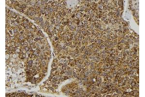 ABIN6274096 at 1/100 staining Human pancreas tissue by IHC-P. (EPH Receptor B6 Antikörper  (Internal Region))