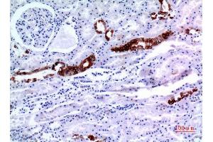 Immunohistochemistry (IHC) analysis of paraffin-embedded Human Kidney, antibody was diluted at 1:100. (KRT8 Antikörper  (Ser726, Ser731))