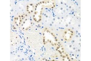 Immunohistochemistry (Paraffin-embedded Sections) (IHC (p)) image for anti-THO Complex 1 (THOC1) antibody (ABIN7264235)