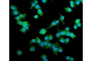 IF analysis of AKAP12 using anti-AKAP12 antibody (ABIN7601563).