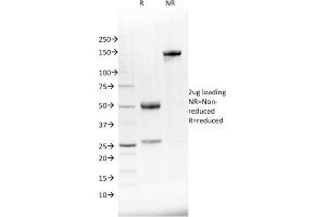 SDS-PAGE Analysis Purified NKX2. (NKX2-8 Antikörper  (AA 10-123))