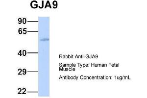 Host: Rabbit Target Name: GJA9 Sample Type: Human Fetal Muscle Antibody Dilution: 1. (GJA9 Antikörper  (Middle Region))