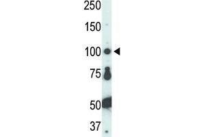 Western Blotting (WB) image for anti-FER Tyrosine Kinase (FER) antibody (ABIN3003442) (FER Antikörper)