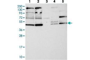 Western blot analysis of Lane 1: RT-4, Lane 2: U-251 MG, Lane 3: Human Plasma, Lane 4: Liver, Lane 5: Tonsil with RNF44 polyclonal antibody  at 1:250-1:500 dilution. (RNF44 Antikörper)