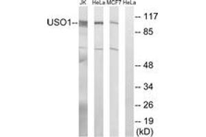 Western blot analysis of extracts from MCF-7/HeLa/Jurkat cells, using USO1 Antibody. (USO1 Antikörper  (AA 913-962))