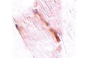 Immunohistochemistry (IHC) image for anti-Glioblastoma Amplified Sequence (GBAS) (Middle Region) antibody (ABIN1031016) (GBAS Antikörper  (Middle Region))