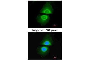 ICC/IF Image Immunofluorescence analysis of paraformaldehyde-fixed HeLa, using Cytochrome P450 4A11, antibody at 1:200 dilution. (CYP4A11 Antikörper  (Center))