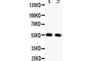 Anti-GLUT4 Picoband antibody,  All lanes: Anti GLUT4  at 0.