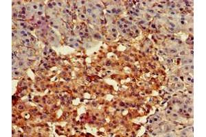 Immunohistochemistry of paraffin-embedded human pancreatic tissue using ABIN7153185 at dilution of 1:100 (FZD4 Antikörper  (AA 37-222))