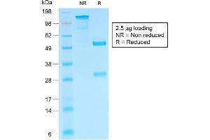 SDS-PAGE Analysis of Purified hCG beta Rabbit Recombinant Monoclonal Antibody (HCGb/1985R).
