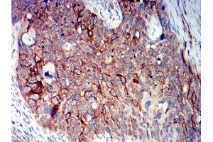 Immunohistochemistry (IHC) image for anti-BCL2-Like 10 (Apoptosis Facilitator) (BCL2L10) (AA 31-186) antibody (ABIN5611302)