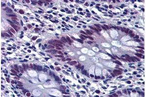 Human Colon: Formalin-Fixed, Paraffin-Embedded (FFPE)