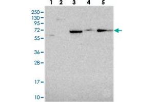 Western blot analysis of Lane 1: RT-4, Lane 2: U-251 MG, Lane 3: Human Plasma, Lane 4: Liver, Lane 5: Tonsil with ALDH1A3 polyclonal antibody  at 1:250-1:500 dilution. (ALDH1A3 Antikörper)