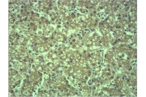 Immunohistochemistry (IHC) analysis of paraffin-embedded Mouse Liver Tissue using EPG5 Polyclonal Antibody. (EPG5 Antikörper)