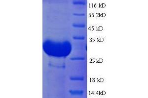 Vitamin B12-Binding (AA 24-266), (full length) protein (His tag)