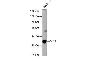Western blot analysis of extracts of Rat brain using DLX2 Polyclonal Antibody at dilution of 1:1000. (DLX2 Antikörper)