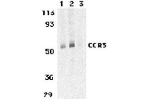 Western Blotting (WB) image for anti-Chemokine (C-C Motif) Receptor 3 (CCR3) antibody (ABIN2478967)