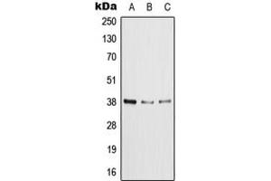 Western blot analysis of XRCC4 expression in HeLa (A), MCF7 (B), NIH3T3 (C) whole cell lysates.
