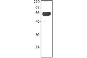 Image no. 1 for anti-Triggering Receptor Expressed On Myeloid Cells 1 (TREM1) antibody (ABIN205544) (TREM1 Antikörper)