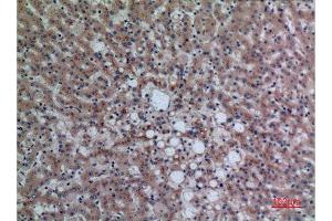 Immunohistochemistry (IHC) analysis of paraffin-embedded Human Liver, antibody was diluted at 1:100. (DPP7 Antikörper  (C-Term))