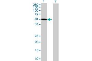 Western Blot analysis of RNF113A expression in transfected 293T cell line (RNF113A Antikörper)