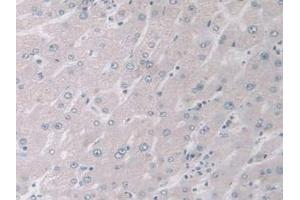 Detection of MAPK12 in Human Liver Tissue using Polyclonal Antibody to Mitogen Activated Protein Kinase 12 (MAPK12) (MAPK12 Antikörper  (AA 27-311))