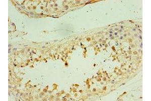 Immunohistochemistry of paraffin-embedded human testis tissue using ABIN7171237 at dilution of 1: 100