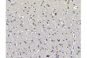 ABIN7096457 and ABIN7100521 at 1/100 staining rat brain tissue by IHC-P. (EXOSC9 Antikörper)