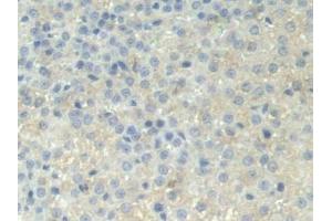 DAB staining on IHC-P; Samples: Rat Adrenal gland Tissue