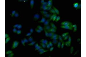 Immunofluorescence staining of HepG2 cells with ABIN7173778 at 1:50, counter-stained with DAPI. (TNFAIP8L1 Antikörper  (AA 1-186))