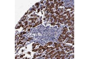 Immunohistochemical staining (Formalin-fixed paraffin-embedded sections) of human liver with MAP3K9 polyclonal antibody  shows strong cytoplasmic positivity in hepatocytes. (MAP3K9 Antikörper)
