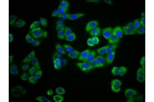 Immunofluorescence staining of PC-3 cells with ABIN7163650 at 1:66, counter-stained with DAPI. (PLEKHG5 Antikörper  (AA 821-957))
