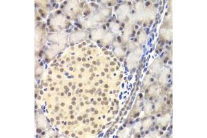Immunohistochemistry of paraffin-embedded rat pancreas using PAWR Antibody (ABIN5971565) at dilution of 1/200 (40x lens). (PAWR Antikörper)