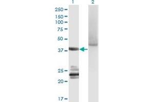Western Blot analysis of GNA14 expression in transfected 293T cell line by GNA14 monoclonal antibody (M06A), clone 2H8. (GNa14 Antikörper  (AA 150-250))