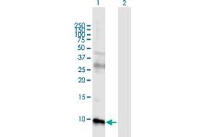 Western Blot analysis of GUCA2B expression in transfected 293T cell line by GUCA2B MaxPab polyclonal antibody. (GUCA2B Antikörper  (AA 1-112))