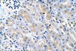 Image no. 1 for anti-Tumor Susceptibility Gene 101 (TSG101) (AA 121-170) antibody (ABIN202410)