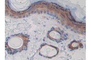 Detection of CD244 in Rat Skin Tissue using Polyclonal Antibody to Cluster of Differentiation 244 (CD244) (2B4 Antikörper  (AA 20-221))