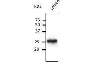 Anti-Rab14 Ab at 1/500 dilution, lysates at 50 µg per Iane, rabbit polyclonal to goat lµg (HR? (RAB5 Antikörper  (C-Term))