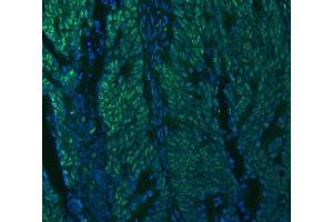 IF analysis of U1A/SNRPA using anti-U1A/SNRPA antibody (ABIN7600891). (SNRPA1 Antikörper  (AA 25-218))