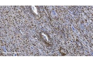 IHC analysis of SAMHD1 using anti-SAMHD1 antibody (ABIN7601514). (SAMHD1 Antikörper  (AA 37-626))