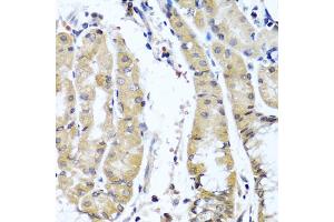Immunohistochemistry of paraffin-embedded human stomach using COL9A1 antibody (ABIN5975036) at dilution of 1/100 (40x lens). (COL9A1 Antikörper)