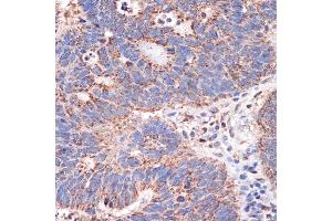 Immunohistochemistry (IHC) image for anti-Prohibitin 2 (PHB2) antibody (ABIN7269545)