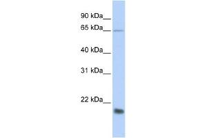 Western Blotting (WB) image for anti-Mucin 1 (MUC1) (Middle Region) antibody (ABIN2776818)