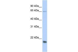 WB Suggested Anti-MUC1 Antibody Titration:  0. (MUC1 Antikörper  (Middle Region))