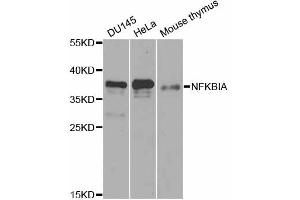 Western blot analysis of extracts of various cell lines, using NFKBIA antibody. (NFKBIA Antikörper)