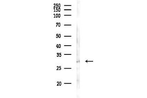 anti-SIX Homeobox 2 (SIX2) (Internal Region) antibody
